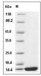 Rat Interleukin-2 / IL-2 Protein SDS-PAGE