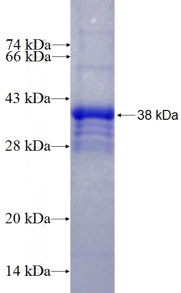 Recombinant Human PNPLA3 SDS-PAGE