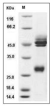 Mouse IL-12 (IL12A & IL12B Heterodimer) Protein SDS-PAGE