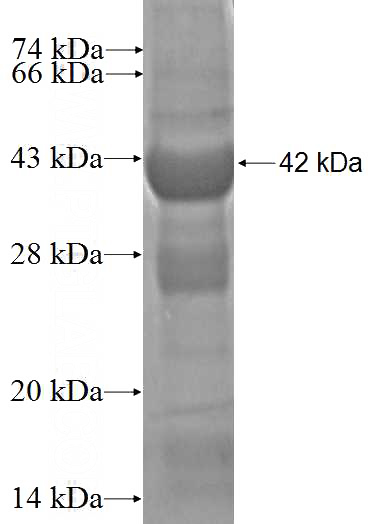Recombinant Human RGS13 SDS-PAGE