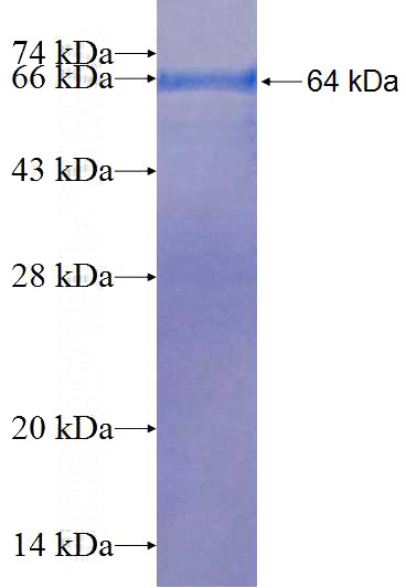 Recombinant Human TELO2 SDS-PAGE