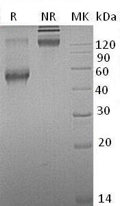 Mouse Acvrl1/Acvrlk1/Alk-1 (Fc tag) recombinant protein