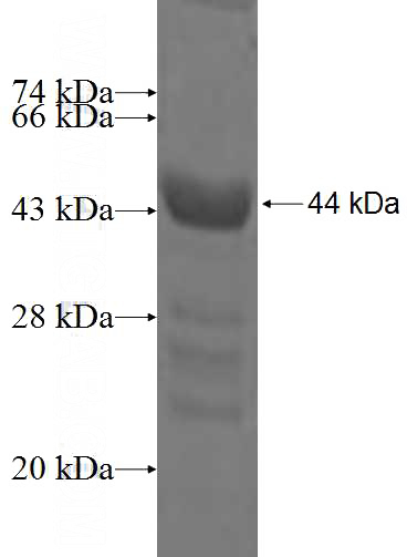 Recombinant Human PYCR1 SDS-PAGE