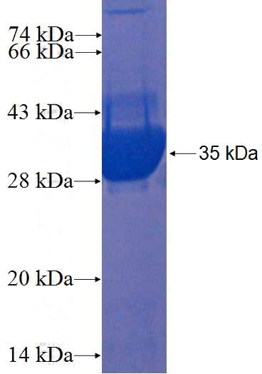 Recombinant Human DPH3 SDS-PAGE