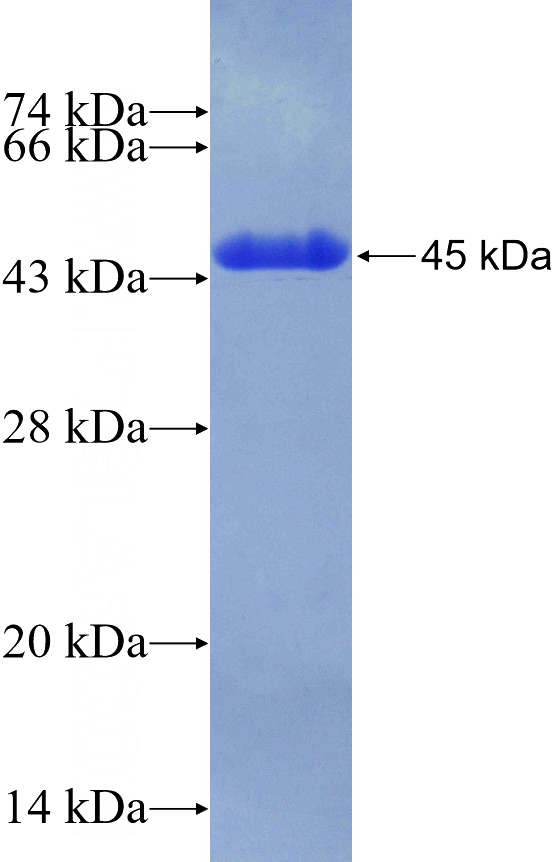 Recombinant Human C9orf125 SDS-PAGE