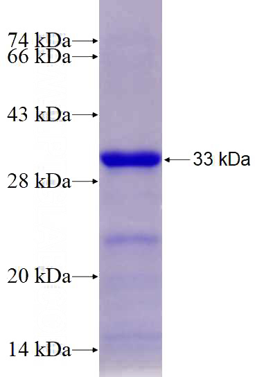 Recombinant Human SCNN1D SDS-PAGE
