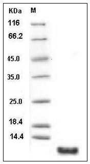 Human S100P / S100E Protein SDS-PAGE