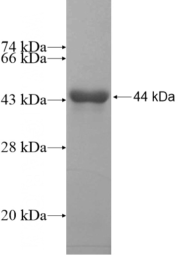 Recombinant Human PHACTR3 SDS-PAGE