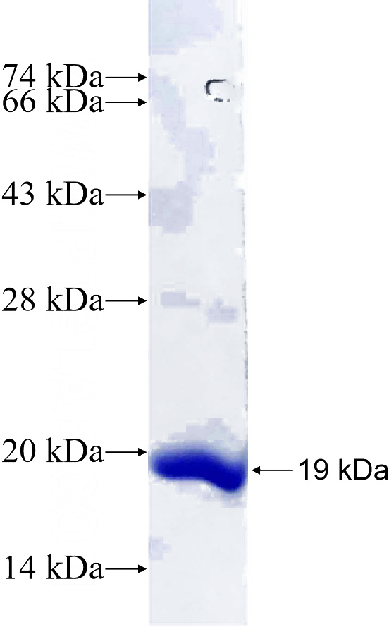Recombinant Human SAMD10 SDS-PAGE