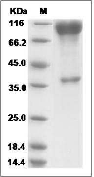 Rat SLC3A2 / CD98 Protein (Fc Tag)