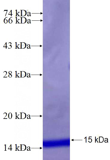 Recombinant Human CLDN16 SDS-PAGE
