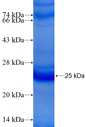 Recombinant Human RHOH SDS-PAGE