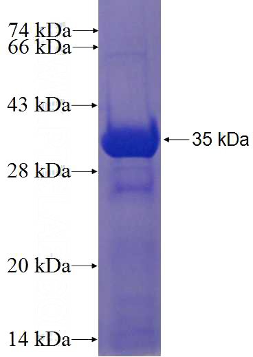 Recombinant Human GLS SDS-PAGE