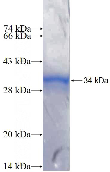 Recombinant Human ADARB2 SDS-PAGE