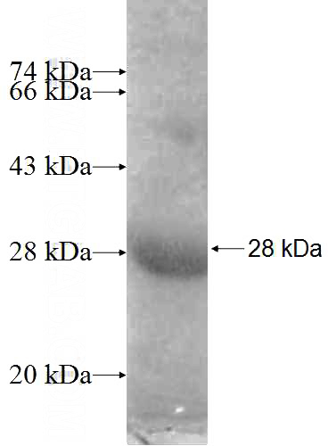 Recombinant Human ERCC8 SDS-PAGE