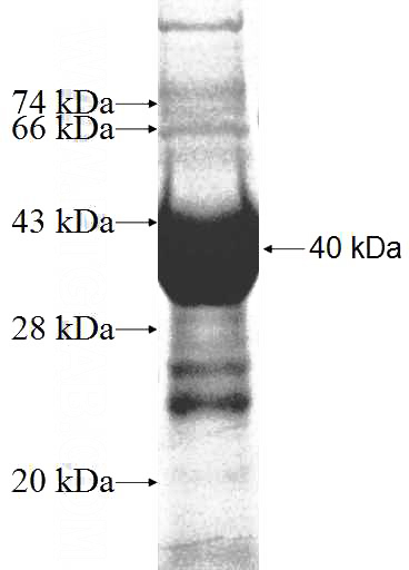 Recombinant Human NFKBIL2 SDS-PAGE