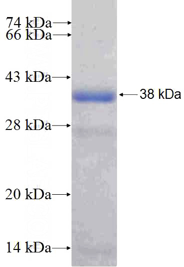 Recombinant Human DNAJA3 SDS-PAGE