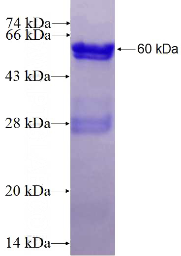 Recombinant Human GEM SDS-PAGE