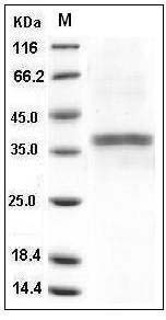 Mouse ACP5 / TRAP Protein (His Tag) SDS-PAGE