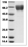 Influenza A H3N2 (A/Switzerland/9715293/2013) Hemagglutinin / HA Protein (His Tag)