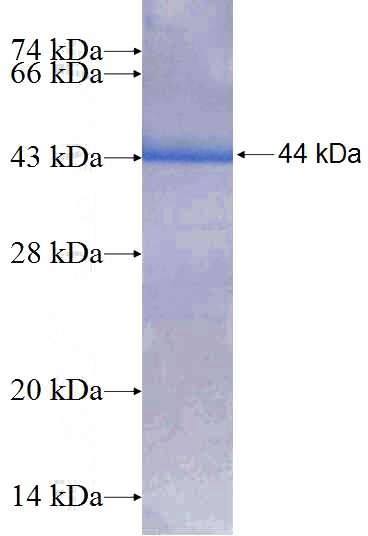 Recombinant Human FEM1A SDS-PAGE