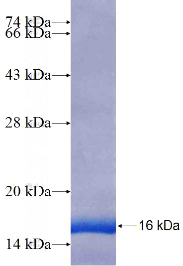 Recombinant Human VPS8 SDS-PAGE