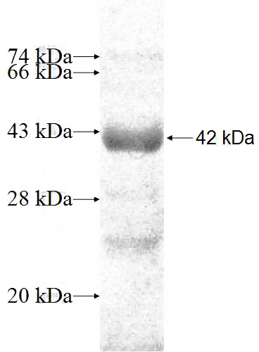 Recombinant Human VARS2 SDS-PAGE