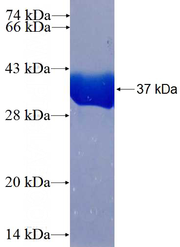 Recombinant Human PIP5K1C SDS-PAGE