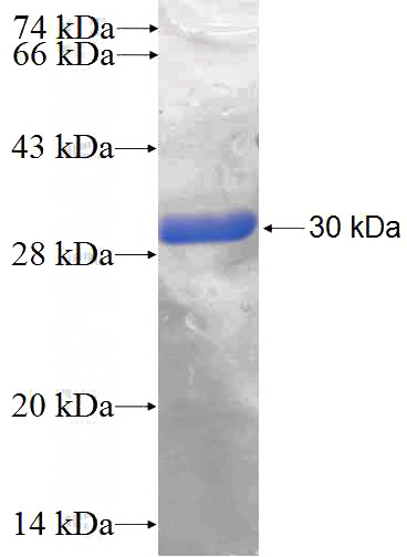 Recombinant Human RRAS SDS-PAGE