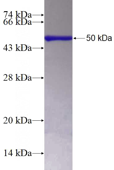 Recombinant Human IP6K2 SDS-PAGE