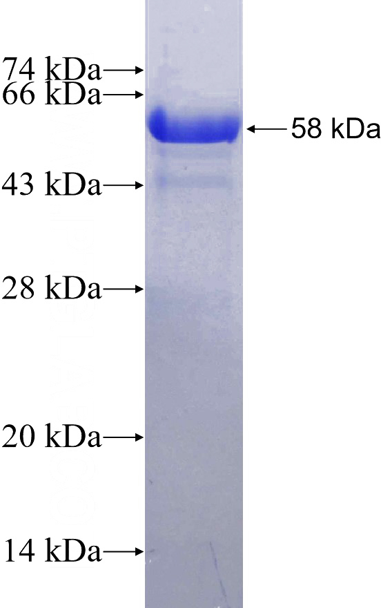 Recombinant Human RPA4 SDS-PAGE