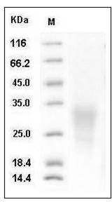 Human BMPRIA / ALK-3 / CD292 Protein (His Tag)