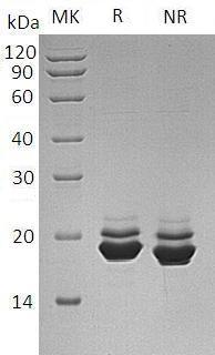Human APLP1 (His tag) recombinant protein
