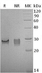 Mouse Igfbp6/Igfbp-6 (His tag) recombinant protein
