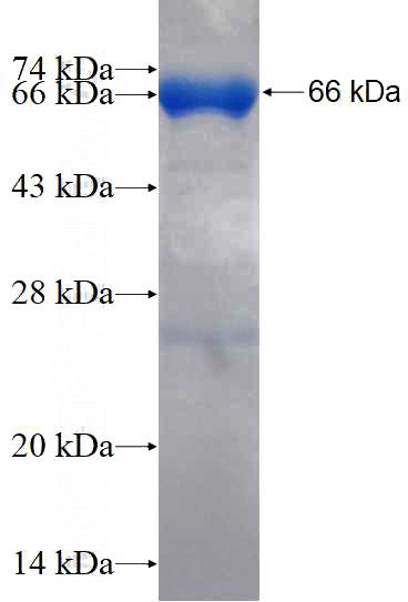 Recombinant Human KIDINS220 SDS-PAGE