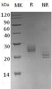 Human EFNA1/EPLG1/LERK1/TNFAIP4 (His tag) recombinant protein