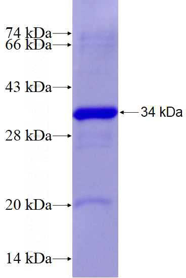 Recombinant Human NOS2 SDS-PAGE