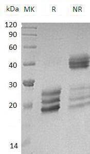 Human IL25/IL17E/UNQ3120/PRO10272 (His tag) recombinant protein