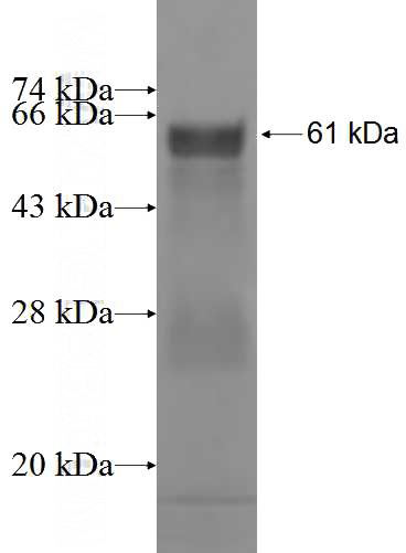 Recombinant Human CBP80 SDS-PAGE