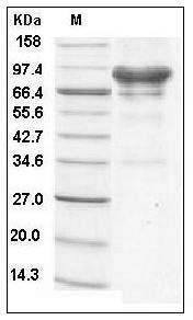 Human Carbonic Anhydrase IX / CA9 Protein (Fc Tag) SDS-PAGE