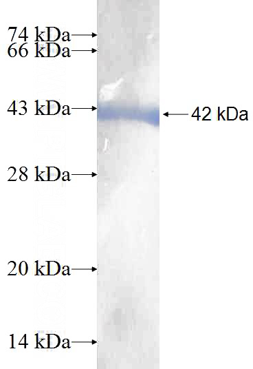 Recombinant Human NANS SDS-PAGE