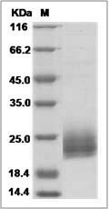 Rat Niemann-Pick disease type C2 / NPC2 Protein (His Tag)