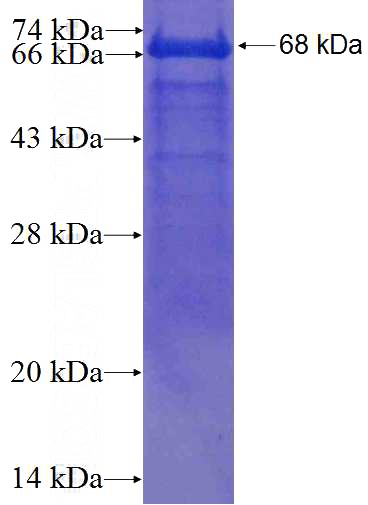 Recombinant Human DCLRE1B SDS-PAGE