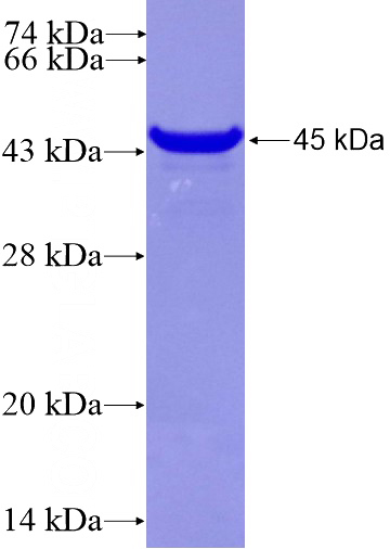 Recombinant Human RANBP10 SDS-PAGE