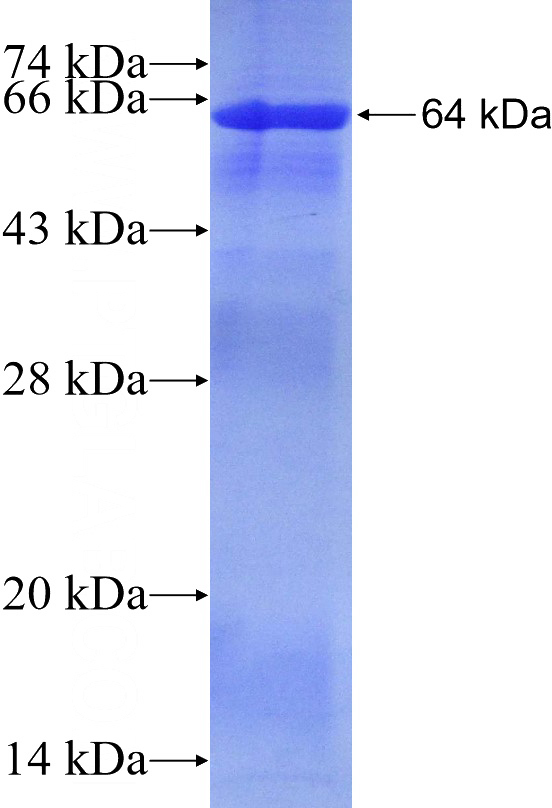 Recombinant Human HNRNPA2B1 SDS-PAGE