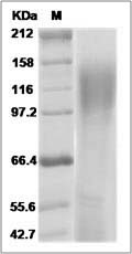 Simian immunodeficiency virus (SIV) (isolate SIVmac251v31523ru28) envelope glycoprotein gp120 Protein (His Tag)