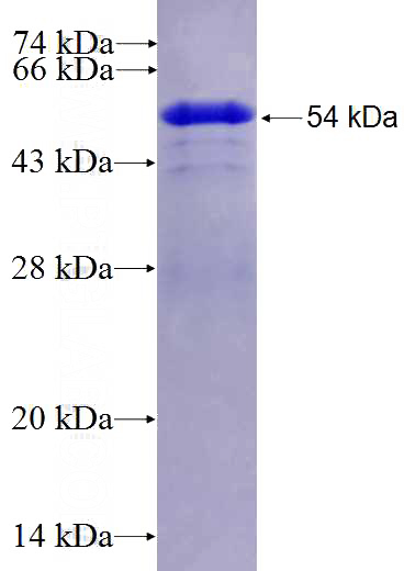 Recombinant Human SH3TC2 SDS-PAGE