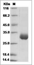 Mouse Angiopoietin 1 / ANG1 / ANGPT1 Protein (His Tag)
