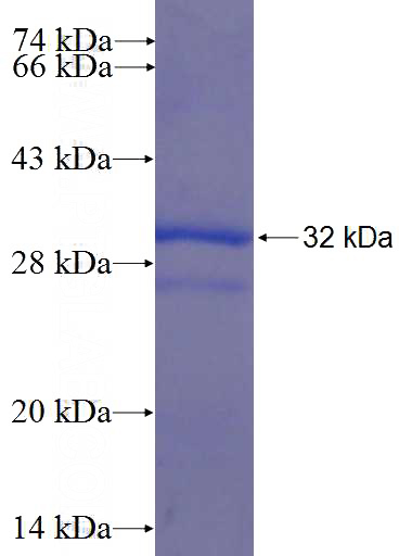 Recombinant Human FASTK SDS-PAGE