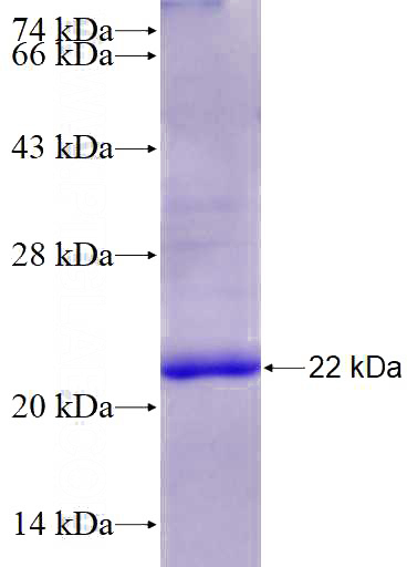 Recombinant Human SEC22C SDS-PAGE